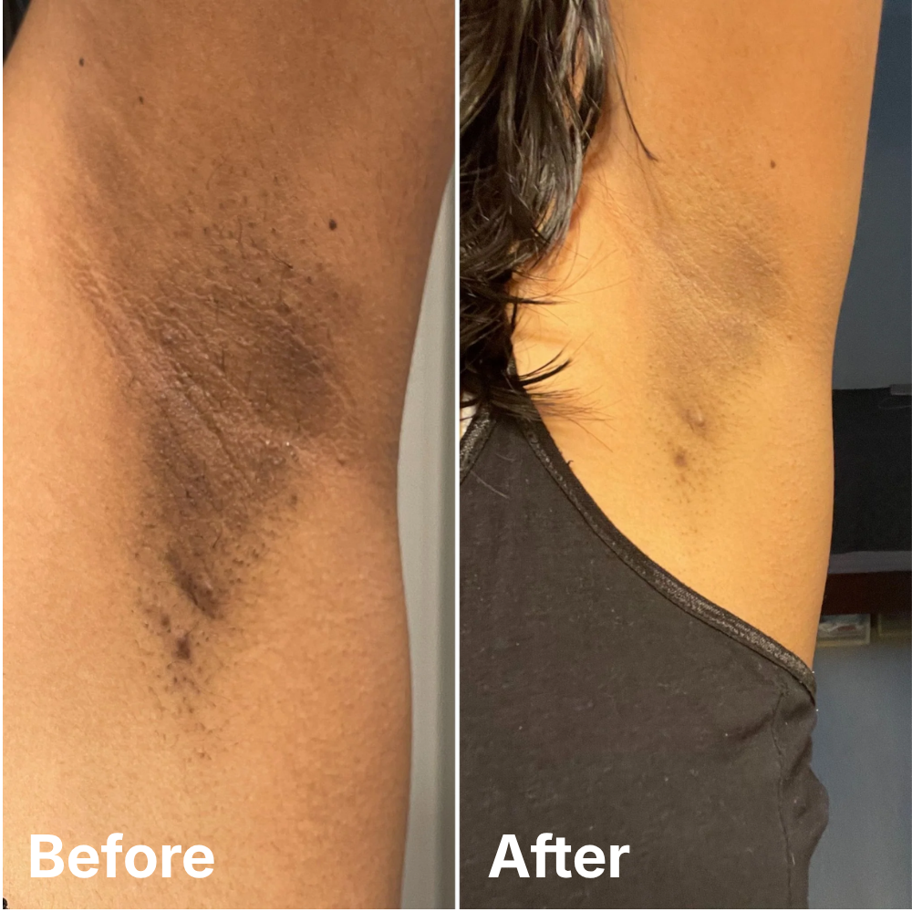 Adaptive Tone-Correcting Spray