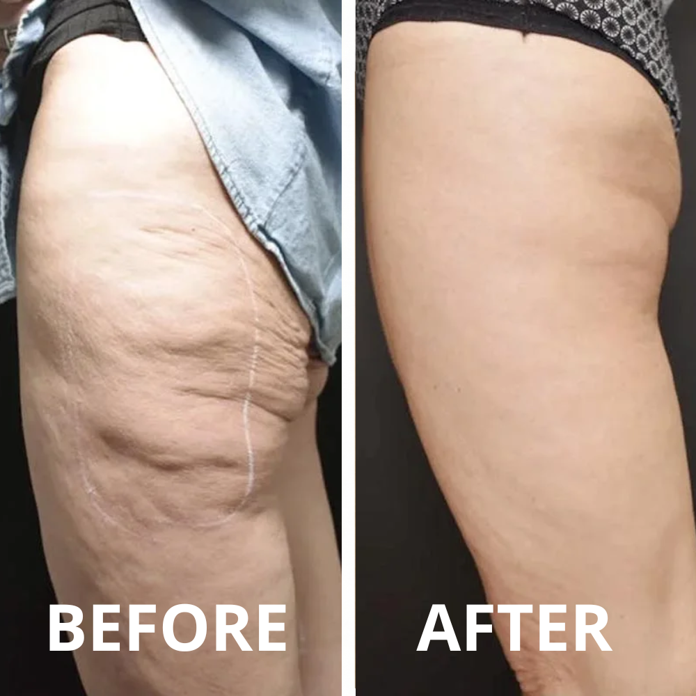 Core Skin™ Sculpt Gel – Smooth, Firm & Tone Your Skin