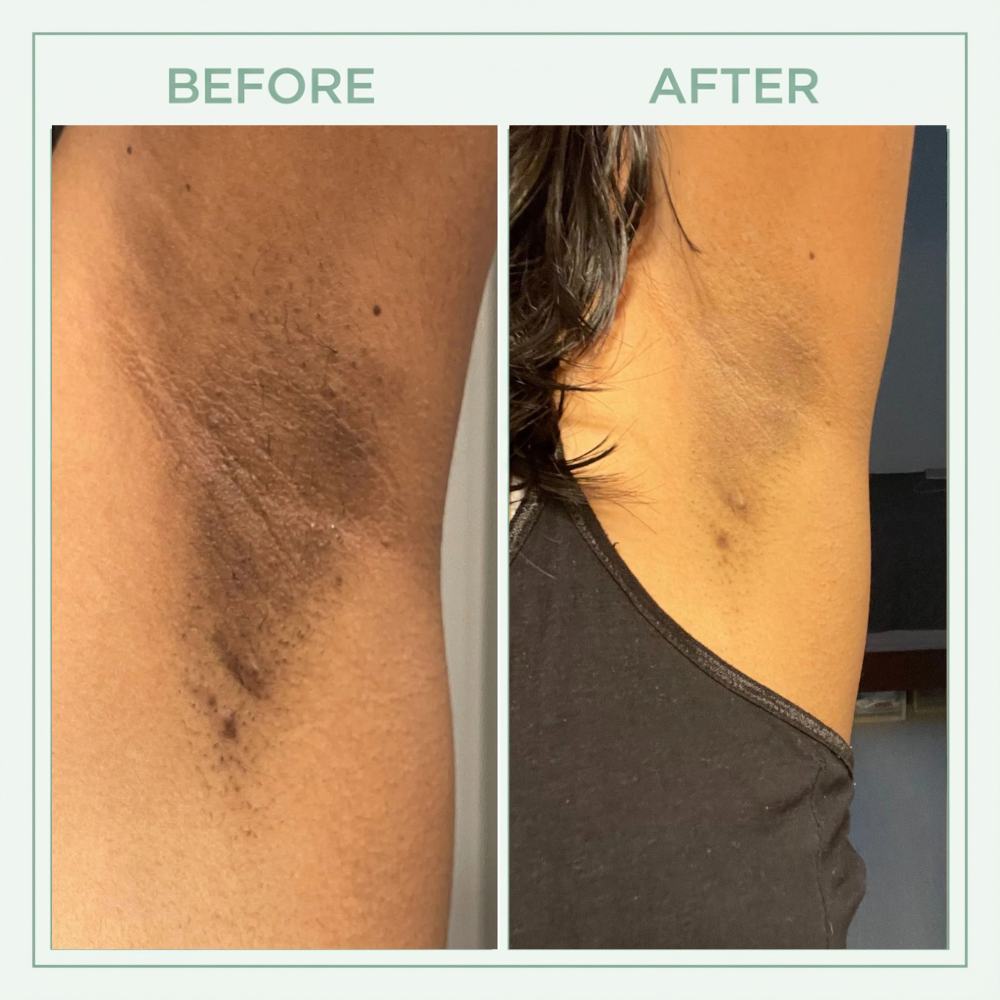 Core Skin™ Bright Peel Spray