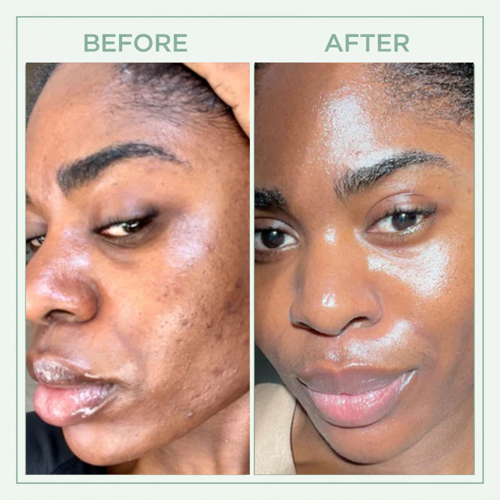 Core Skin™ Bright Peel Spray