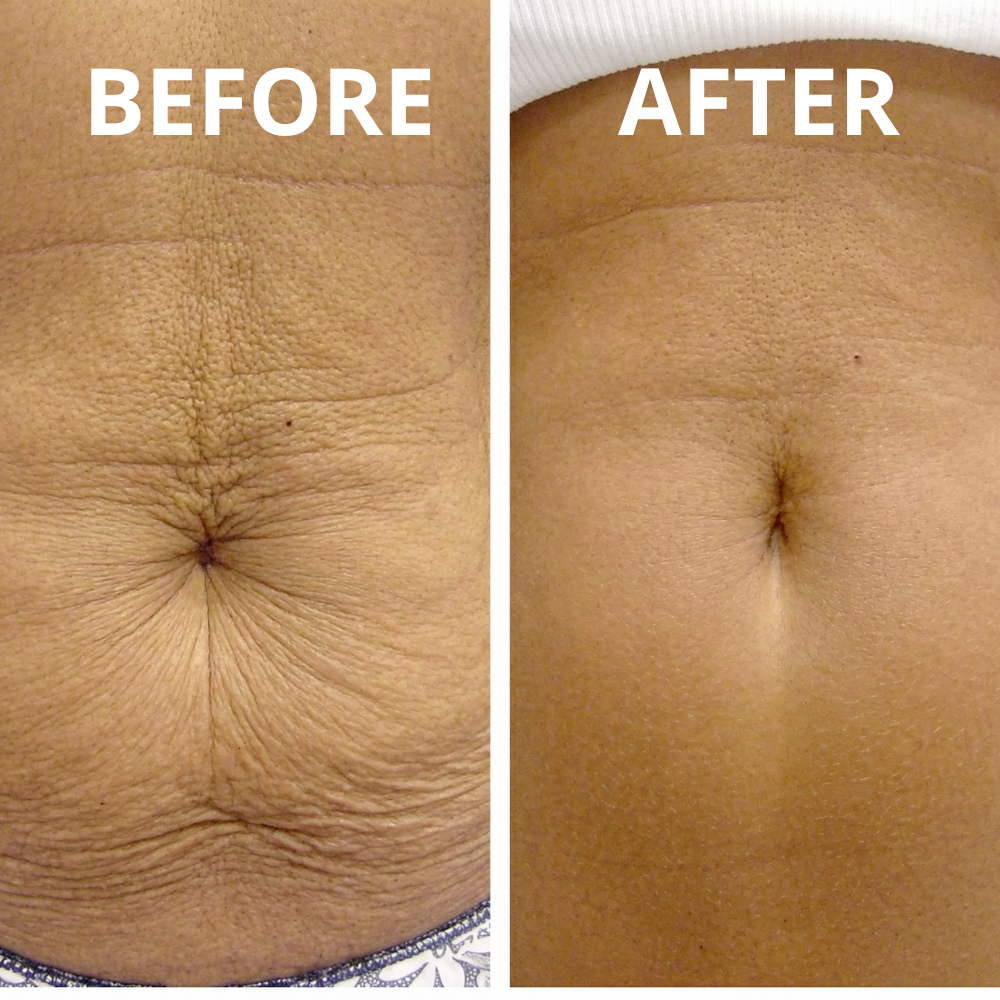 Core Skin™ Sculpt Gel – Glättet, strafft und tonisiert Ihre Haut