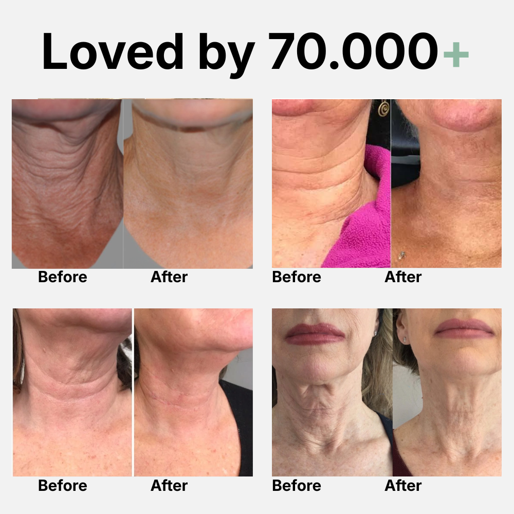 Age-Betraying Neck Recovery