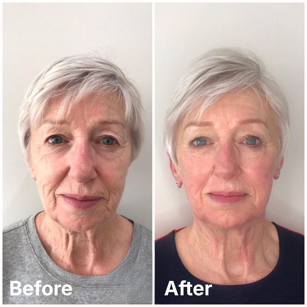 Reverse-Aging Adaptive Firming Serum
