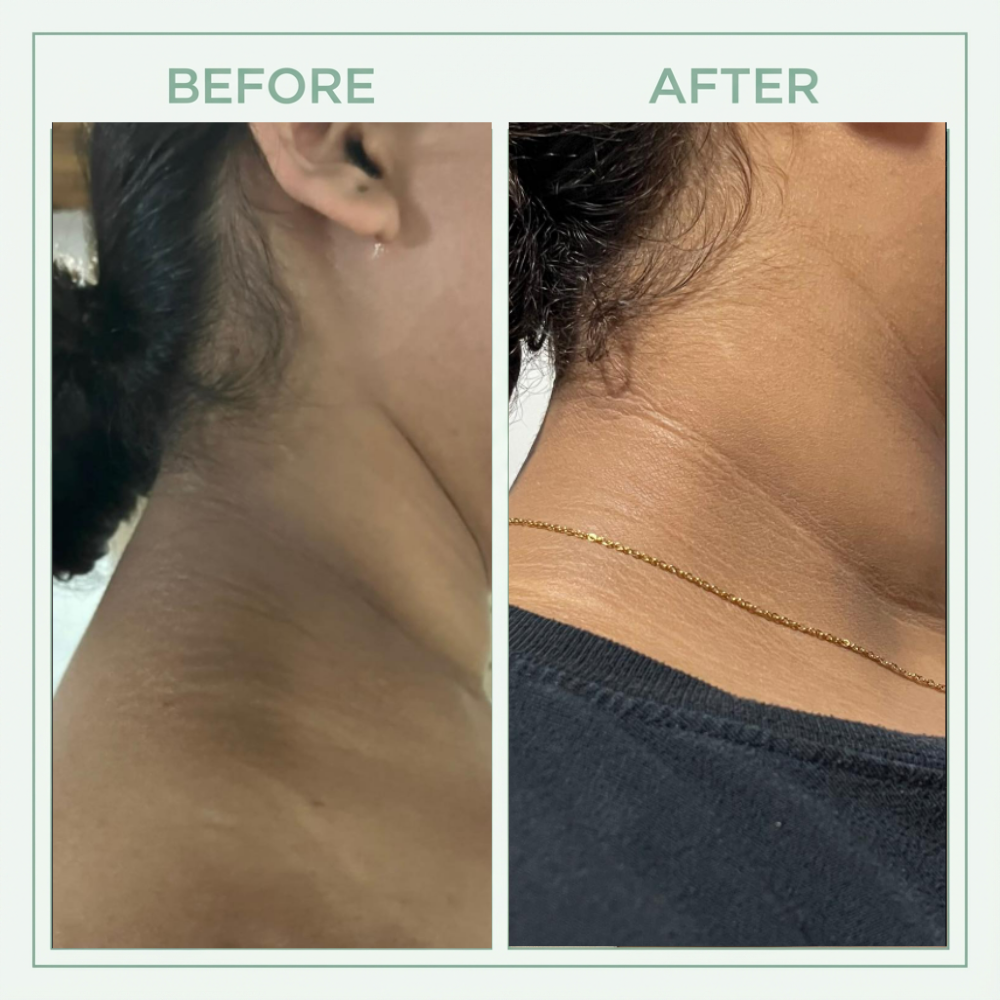 Core Skin™ Bright Peel Spray